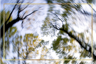 Benign Paroxysmal Positional Vertigo and vestibular hypofunction treatments