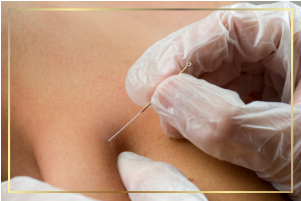 Dry needling for chronic shoulder, neck pain