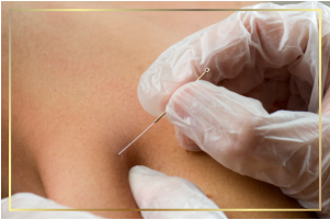 Dry needling for chronic shoulder, neck pain